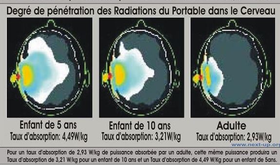 penetration dans le cerveau